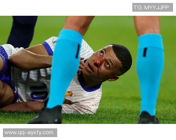 姆巴佩缺席法国训练两天今日将决定能否出战比赛 姆巴佩缺席法国训练两天今日将决定能否出战比赛